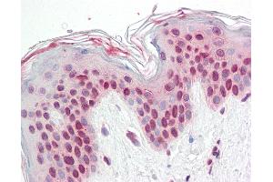 Anti-TFEB antibody IHC staining of human skin. (TFEB 抗体  (N-Term))