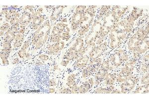 Immunohistochemical analysis of paraffin-embedded human stomach tissue. (Smad2/3 抗体)