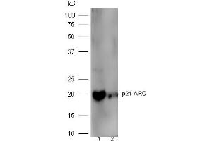 Line1,mouse intestinal lysate; Line2, Raji lysate probed with Rabbit Anti-p21-ARC Polyclonal Antibody, Unconjugated (ABIN2178124) at 1:300 in 4˚C. (ARPC3 抗体  (AA 2-100))