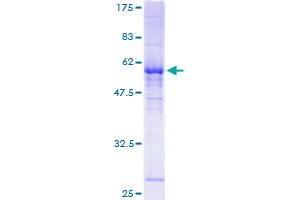 Image no. 1 for Ral GEF with PH Domain and SH3 Binding Motif 1 (RALGPS1) (AA 1-305) protein (GST tag) (ABIN1317353) (RALGPS1 Protein (AA 1-305) (GST tag))