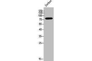 Western Blot analysis of JK cells using Phospho-GRK 2 (S685) Polyclonal Antibody (GRK2 抗体  (pSer685))