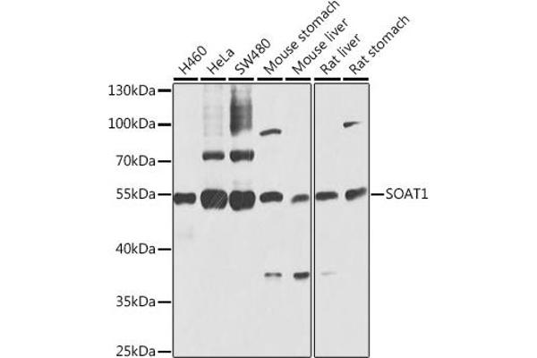 SOAT1 抗体  (AA 1-130)