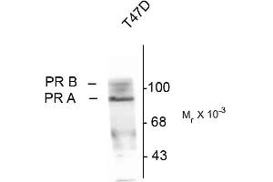 Western blots of whole cell T47D lysate prepared from cells that had been inubated in the presence of the synthetic progestin agonist R5020 (500 nM) showing specific immunolabeling of the ~90k PR-A isoform and the ~120 PR-B isoform of the progesterone receptor phosphorylated at Ser190. (Progesterone Receptor 抗体  (pSer190))