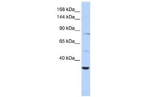 AHNAK2 antibody used at 1 ug/ml to detect target protein. (AHNAK2 抗体  (Middle Region))