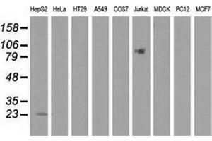 Western blot analysis of extracts (35 µg) from 9 different cell lines by using anti-PEBP1 monoclonal antibody. (PEBP1 抗体)