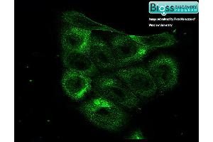 Immunofluorescence (IF) image for anti-Hypoxia Inducible Factor 1, alpha Subunit (Basic Helix-Loop-Helix Transcription Factor) (HIF1A) (AA 341-450) antibody (ABIN672546)