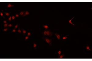 ABIN6269380 staining HeLa cells by IF/ICC. (PDCD4 抗体  (C-Term))