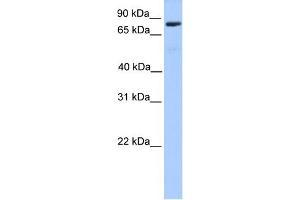 WB Suggested Anti-C12orf40 Antibody Titration: 0. (C12orf40 抗体  (N-Term))
