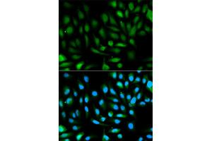 Immunofluorescence analysis of HeLa cells using PARK7 antibody. (PARK7/DJ1 抗体)