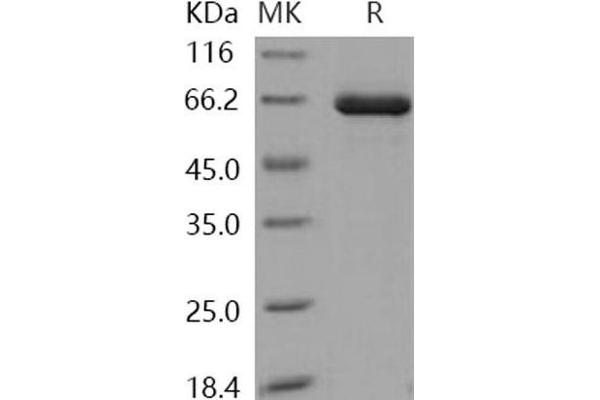 TLK2 Protein (GST tag,His tag)