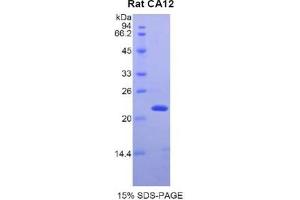 SDS-PAGE analysis of Rat CA12 Protein. (CA12 蛋白)