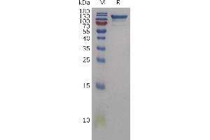 Human SD Protein, His Tag on SDS-PAGE under reducing condition. (SEMA4D/CD100 Protein (AA 22-734) (His tag))