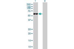 Western Blotting (WB) image for VIM 293T Cell Transient Overexpression Lysate(Denatured) (ABIN1333888)