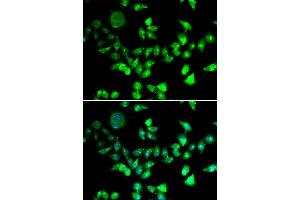 Immunofluorescence analysis of U20S cell using SMC1A antibody. (SMC1A 抗体)