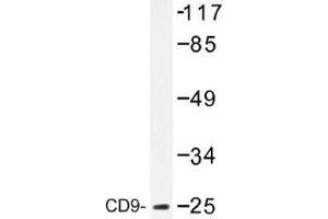 Image no. 1 for anti-CD9 (CD9) antibody (ABIN317808) (CD9 抗体)