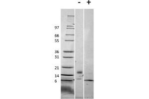 SDS-PAGE of Mouse RELM beta Recombinant Protein SDS-PAGE of Mouse RELM beta Recombinant Protein. (RETNLB 蛋白)