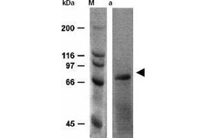 Western Blotting (WB) image for anti-Heat Shock Protein 70 (HSP70) antibody (ABIN191986) (HSP70 抗体)