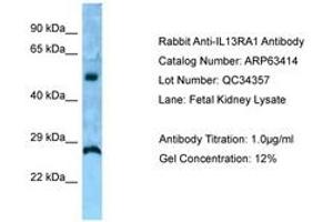 Image no. 1 for anti-Interleukin 13 Receptor, alpha 1 (IL13RA1) (AA 40-89) antibody (ABIN6749982) (IL13 Receptor alpha 1 抗体  (AA 40-89))