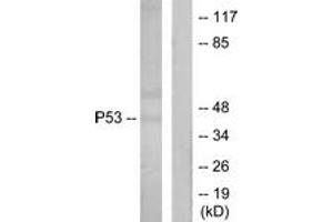 Western blot analysis of extracts from Ovary cancer cells, using p53 (Ab-18) Antibody. (p53 抗体  (AA 15-64))