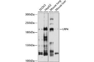Western blot analysis of extracts of various cell lines, using LRP4 antibody (ABIN6130530, ABIN6143327, ABIN6143328 and ABIN6214330) at 1:1000 dilution. (LRP4 抗体  (AA 1500-1725))