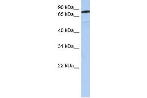 WB Suggested Anti-SEMA4B Antibody Titration:  0. (SEMA4B 抗体  (N-Term))