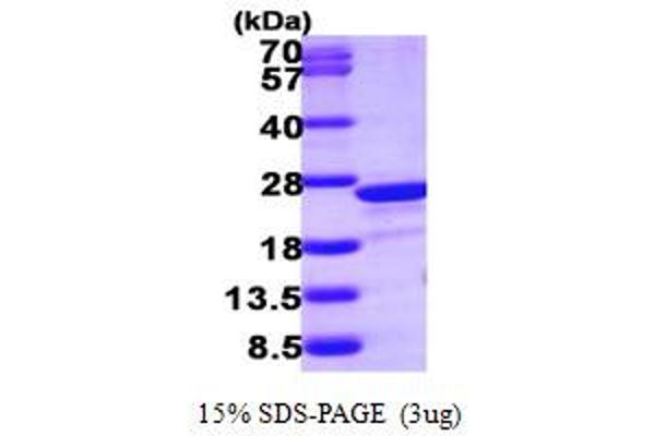 TAGLN2 Protein (AA 13-199) (His tag)