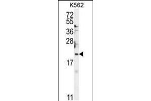 Western blot analysis in K562 cell line lysates (35ug/lane). (BTG2 抗体  (N-Term))