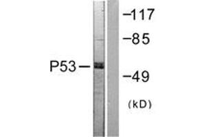 Western blot analysis of extracts from 293 cells, treated with Etoposide 25uM 60', using p53 (Ab-392) Antibody. (p53 抗体  (AA 344-393))