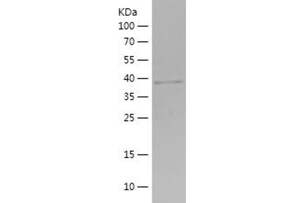 PYGM Protein (AA 64-197) (His-IF2DI Tag)