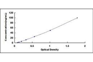 Image no. 1 for Glutamic Acid Decarboxylase Antibody (GAD Ab) ELISA Kit (ABIN1873269) (GAD Ab ELISA 试剂盒)