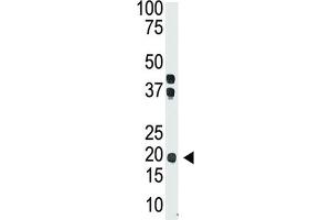 Western Blotting (WB) image for anti-Interleukin 28 (IL28) antibody (ABIN2999201) (IL-28 抗体)