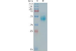 Human (544-643) Protein, hFc Tag on SDS-PAGE under reducing condition. (ERBB3 Protein (AA 544-643) (Fc Tag))