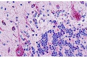 Human Brain, Cerebellum: Formalin-Fixed, Paraffin-Embedded (FFPE) (PIN1 抗体  (AA 1-50))