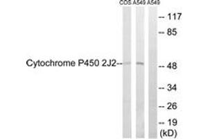 Western Blotting (WB) image for anti-Cytochrome P450, Family 2, Subfamily J, Polypeptide 2 (CYP2J2) (AA 231-280) antibody (ABIN2889947) (CYP2J2 抗体  (AA 231-280))