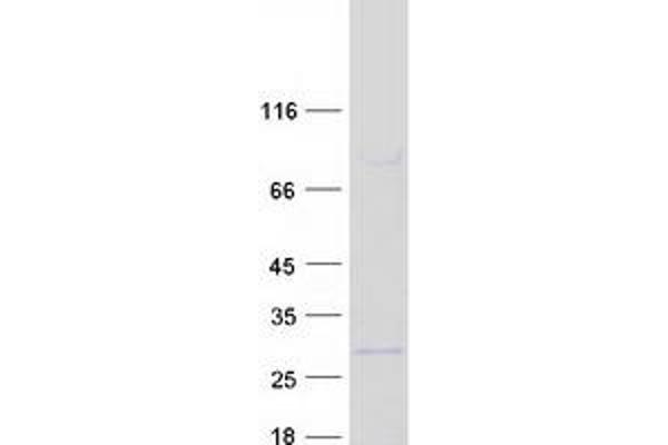 NDUFB9 Protein (Myc-DYKDDDDK Tag)