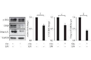 Chrysophanol (Cho) decreased the expression of α-SMA, CTGF, and integrin β-1 in HSC-T6 cells. (Smooth Muscle Actin 抗体)