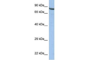 WB Suggested Anti-ZNF630 Antibody Titration:  0. (ZNF630 抗体  (Middle Region))