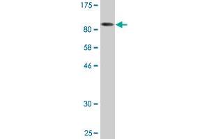 Western Blot detection against Immunogen (142. (HDAC6 抗体  (AA 1-1063))