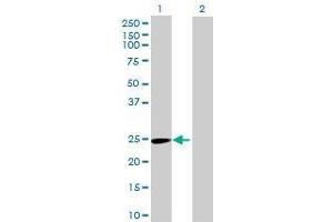 Lane 1: SFRS12IP1 transfected lysate ( 18. (P18SRP 293T Cell Transient Overexpression Lysate(Denatured))