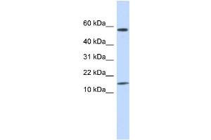 WB Suggested Anti-KRTAP11-1 Antibody Titration:  0. (KRTAP11-1 抗体  (N-Term))