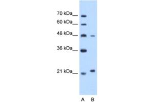 Western Blotting (WB) image for anti-Matrix Metallopeptidase 1 (Interstitial Collagenase) (MMP1) antibody (ABIN2462517) (MMP1 抗体)