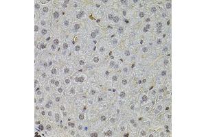 Immunohistochemistry of paraffin-embedded mouse liver using SKP2 antibody (ABIN5995995) at dilution of 1/100 (40x lens). (SKP2 抗体)
