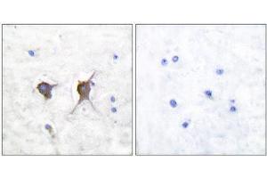 Immunohistochemistry (IHC) image for anti-BCL2-Associated X Protein (BAX) (N-Term) antibody (ABIN1848439) (BAX 抗体  (N-Term))