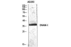 Western Blotting (WB) image for anti-CD226 (CD226) (Tyr570) antibody (ABIN3174791) (CD226 抗体  (Tyr570))