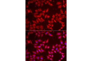 Immunofluorescence analysis of HeLa cells using BAP1 antibody (ABIN5973917). (BAP1 抗体)