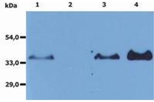 Image no. 1 for anti-Membrane-Spanning 4-Domains, Subfamily A, Member 1 (MS4A1) antibody (ABIN1100549) (CD20 抗体)