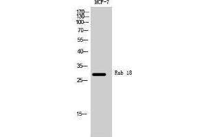 Western Blotting (WB) image for anti-RAB18, Member RAS Oncogene Family (RAB18) (Internal Region) antibody (ABIN3186613) (RAB18 抗体  (Internal Region))