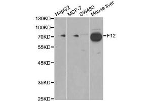 Western blot analysis of extracts of various cell lines, using F12 antibody (ABIN5970845) at 1/1000 dilution. (F12 抗体)