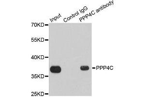 Immunoprecipitation analysis of 200 μg extracts of 293T cells using 1 μg PPP4C antibody (ABIN5971135). (PPP4C 抗体)