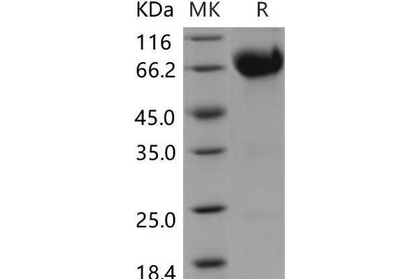 IL10RB Protein (Fc Tag)